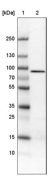 Lane 1: Marker [kDa]<br/>Lane 2: Human cell line U-251 MG