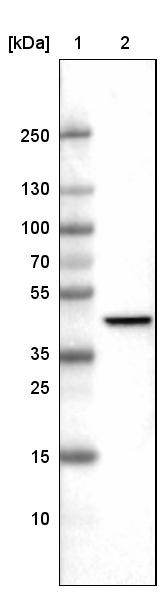 Lane 1: Marker [kDa]<br/>Lane 2:Human cell line U-251 MG