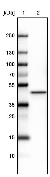 Lane 1: Marker [kDa]<br/>Lane 2: Human cell line U-251 MG
