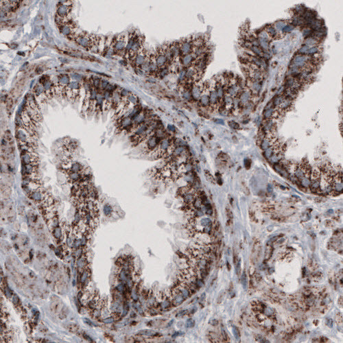 Immunohistochemical staining of human prostate shows granular cytoplasmic immunoreactivity in glandular cells.