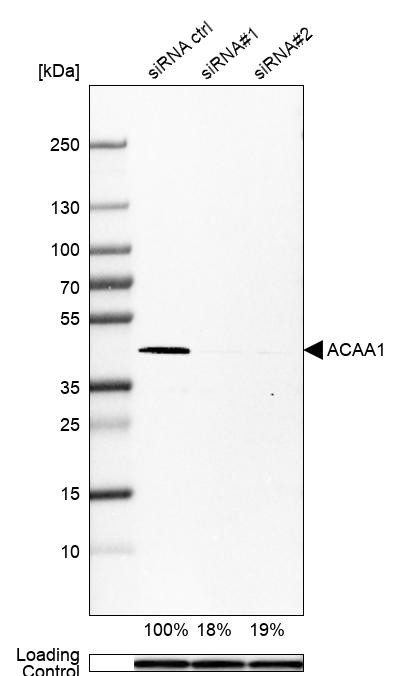 Western blot analysis in U-251MG cells transfected with control siRNA, target specific siRNA probe #1 and #2, using Anti-ACAA1 antibody. Remaining relative intensity is presented. Loading control: Anti-PPIB.