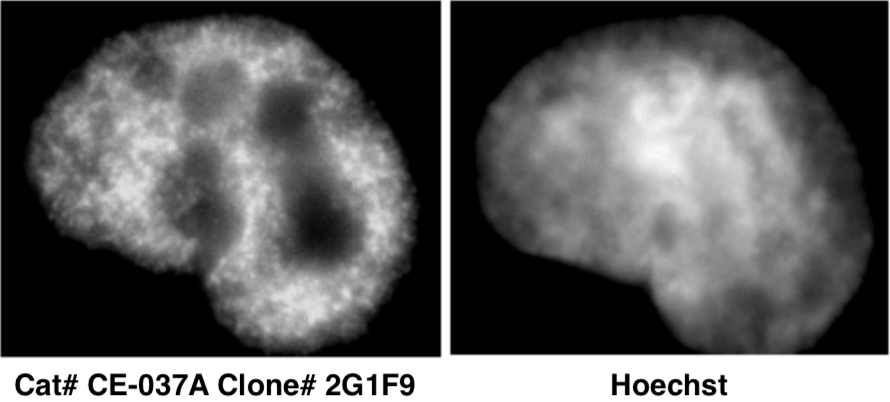 Immunocytochemical analysis of HeLa cells using histone H3 K9ac antibody 2G1F9.