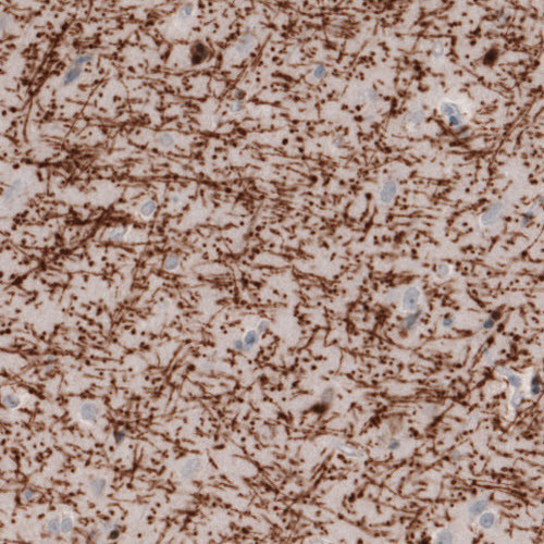 Immunohistochemical staining of human cerebral cortex shows strong immunoreactivity in myelinated fibers.