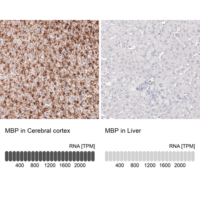 Immunohistochemistry analysis in human cerebral cortex and liver tissues using AMAb91064 antibody. Corresponding MBP RNA-seq data are presented for the same tissues.