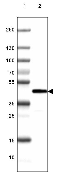 Lane 1: Marker [kDa] 250, 130, 100, 70, 55, 35, 25, 15, 10<br/>Lane 2: Human Cerebral Cortex tissue