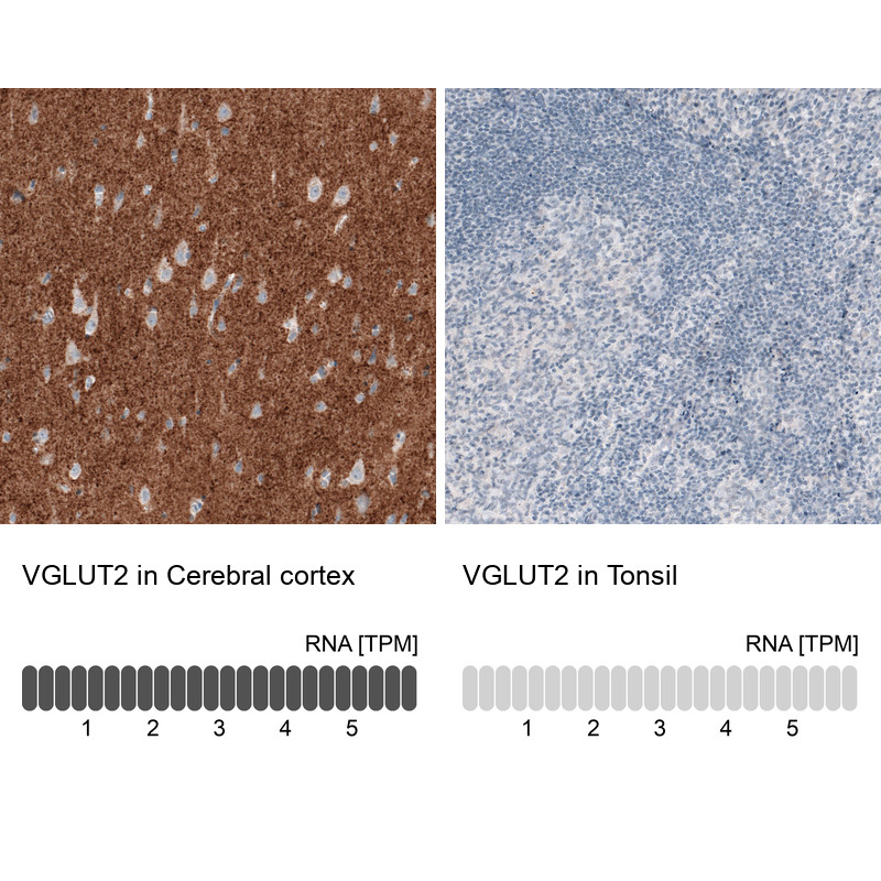 Immunohistochemistry analysis in human cerebral cortex and tonsil tissues using AMAb91081 antibody. Corresponding VGLUT2 RNA-seq data are presented for the same tissues.