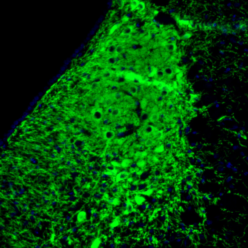 Immunofluorescence staining of rat pons shows strong positivity in noradrenalne neurons in the locus coeruleus.