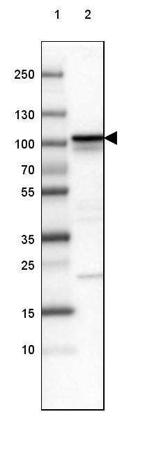 Lane 1: Marker [kDa] 250, 130, 100, 70, 55, 35, 25, 15, 10<br/>Lane 2: Human cell line SK-MEL-30