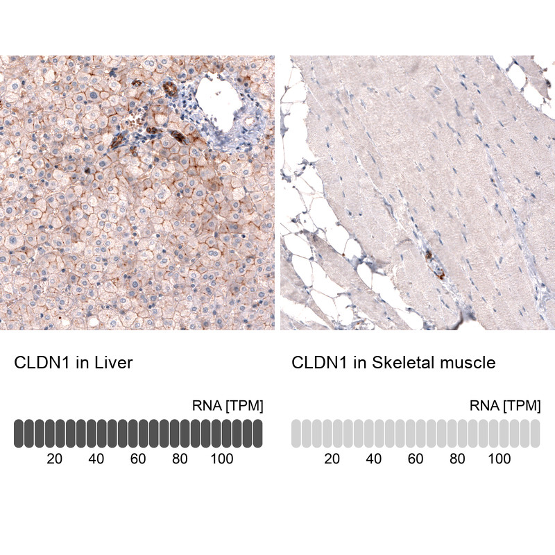Immunohistochemistry analysis in human liver and skeletal muscle tissues using AMAb91213 antibody. Corresponding CLDN1 RNA-seq data are presented for the same tissues.