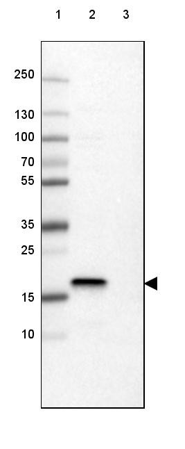 Lane 1: Marker [kDa] 250, 130, 100, 70, 55, 35, 25, 15, 10<br/>Lane 2: Human cell line RT-4<br/>Lane 3: Human cell line U-251 MG