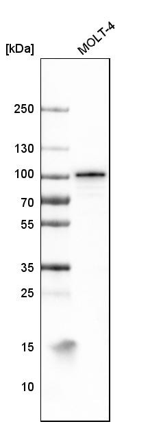 Western blot analysis in human cell line MOLT-4.