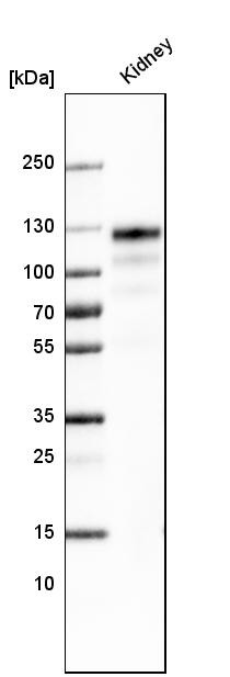 Western blot analysis in human kidney tissue.