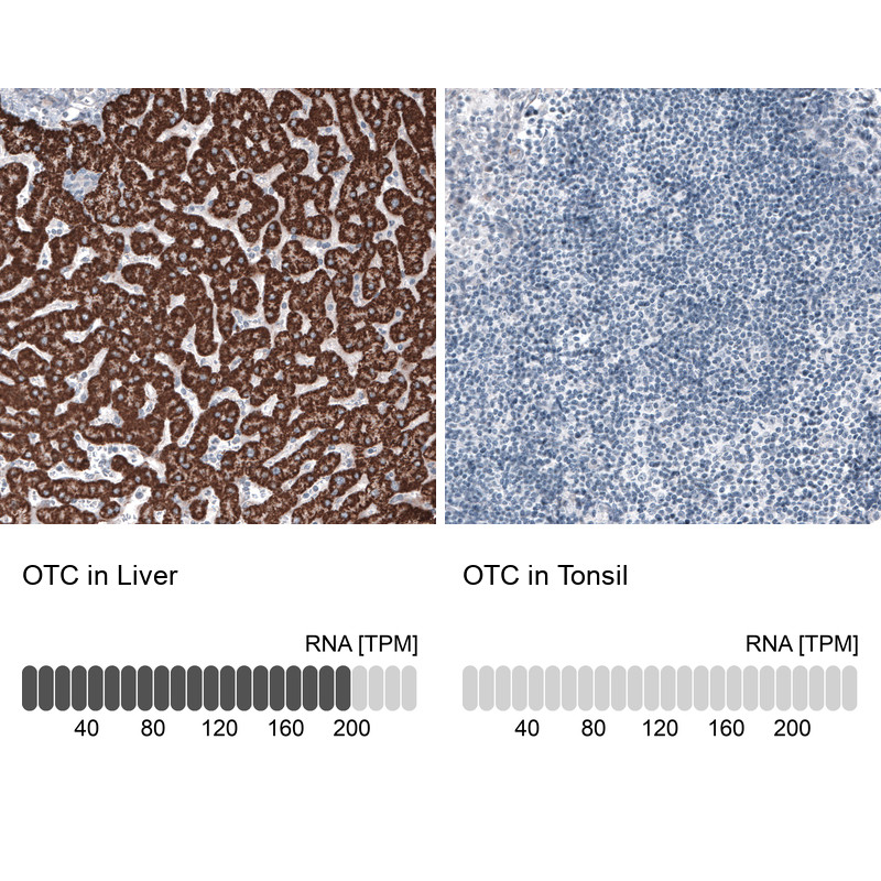 Immunohistochemistry analysis in human liver and tonsil tissues using AMAb91264 antibody. Corresponding OTC RNA-seq data are presented for the same tissues.