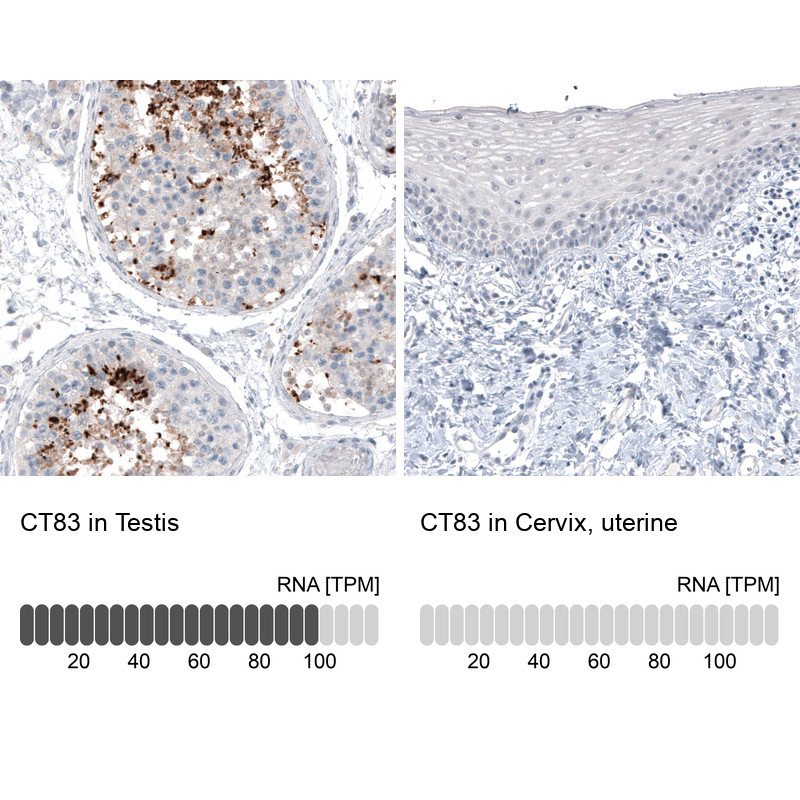 Immunohistochemistry analysis in human testis and cervix, uterine tissues using AMAb91318 antibody. Corresponding CT83 RNA-seq data are presented for the same tissues.