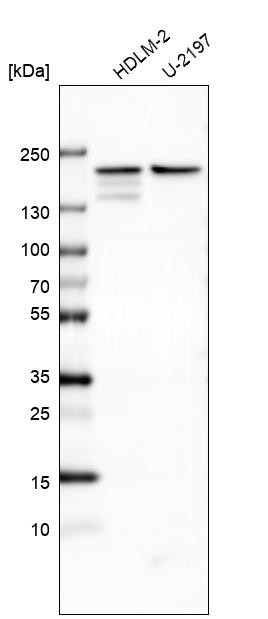 Western blot analysis in human cell line HDLM-2 and human cell line U-2197.