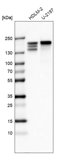 Western blot analysis in human cell line HDLM-2 and human cell line U-2197.