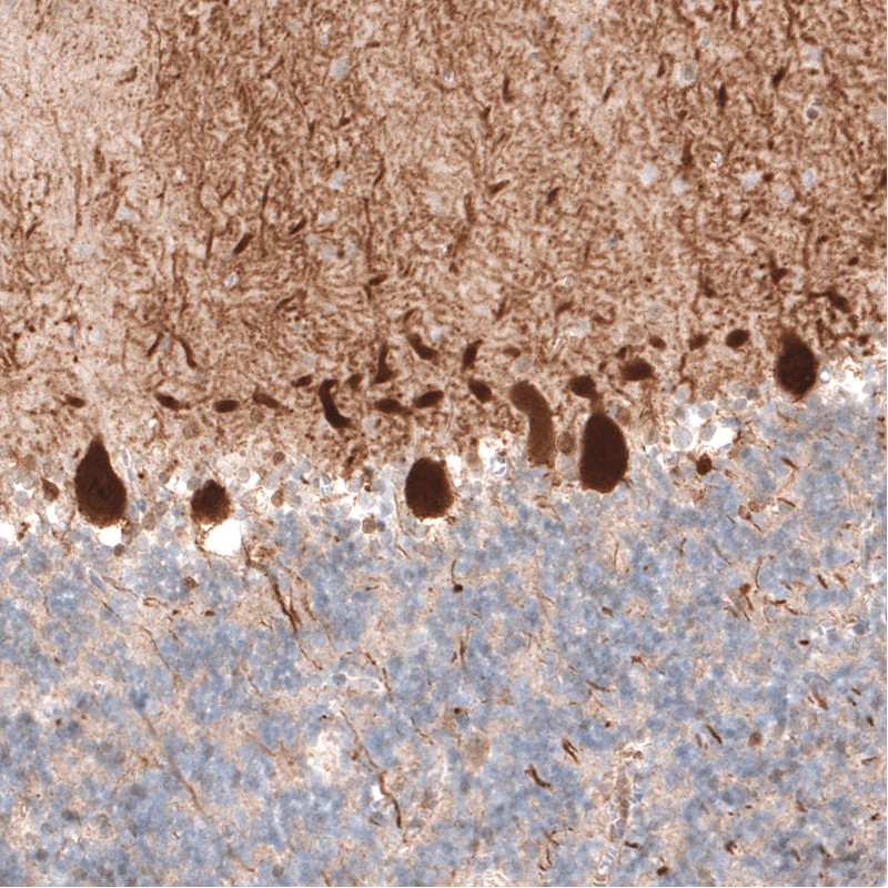 Immunohistochemical staining of human cerebellum shows strong cytoplasmic positivity in Purkinje cells.