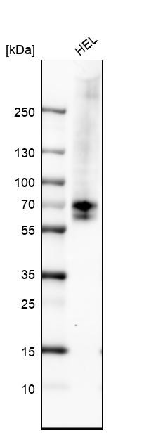 Western blot analysis in human cell line HEL.