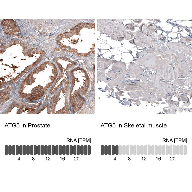 Immunohistochemistry analysis in human prostate and skeletal muscle tissues using AMAb91582 antibody. Corresponding ATG5 RNA-seq data are presented for the same tissues.
