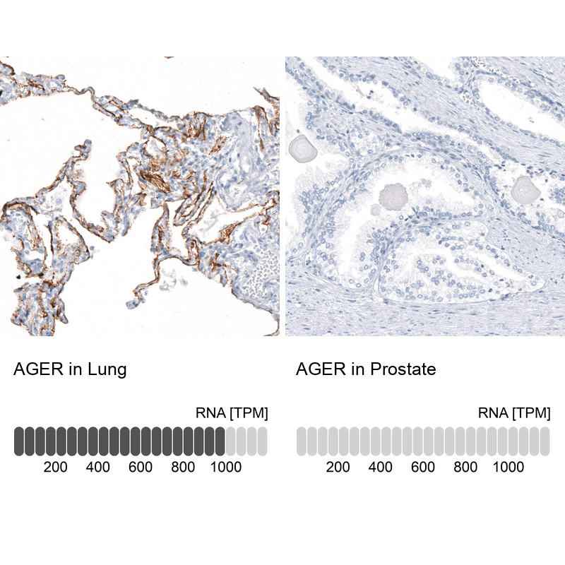 Immunohistochemistry analysis in human lung and prostate tissues using AMAb91635 antibody. Corresponding AGER RNA-seq data are presented for the same tissues.