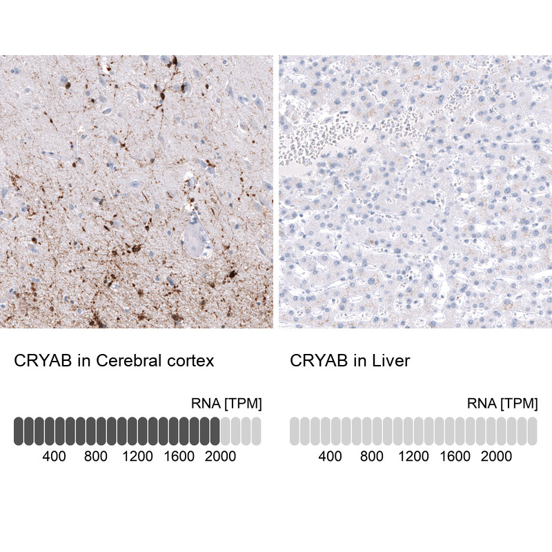 Immunohistochemistry analysis in human cerebral cortex and liver tissues using AMAb91662 antibody. Corresponding CRYAB RNA-seq data are presented for the same tissues.