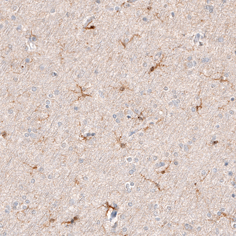 Immunohistochemical staining of human cerebral cortex shows moderate cytoplasmic positivity in microglia.