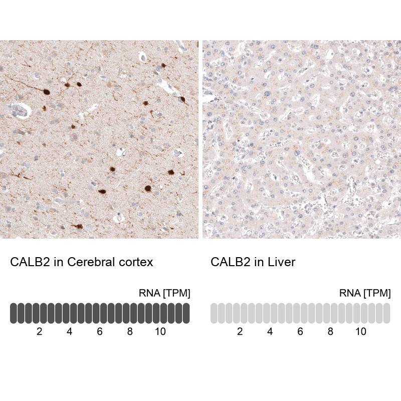 Immunohistochemistry analysis in human cerebral cortex and liver tissues using AMAb91813 antibody. Corresponding CALB2 RNA-seq data are presented for the same tissues.