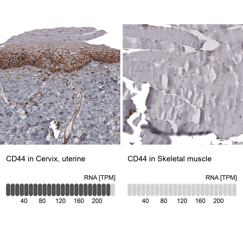 Immunohistochemistry analysis in human cervix, uterine and skeletal muscle tissues using AMAb91847 antibody. Corresponding CD44 RNA-seq data are presented for the same tissues.
