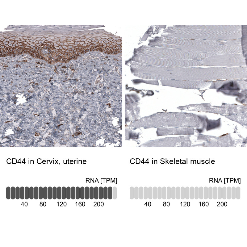 Immunohistochemistry analysis in human cervix, uterine and skeletal muscle tissues using AMAb91848 antibody. Corresponding CD44 RNA-seq data are presented for the same tissues.
