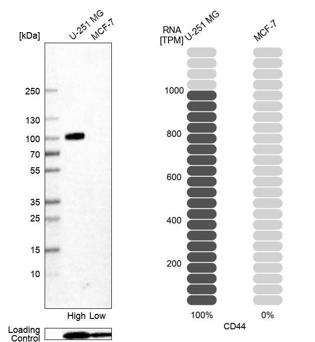 Western blot analysis in human cell line U-251 MG and human cell line MCF-7.