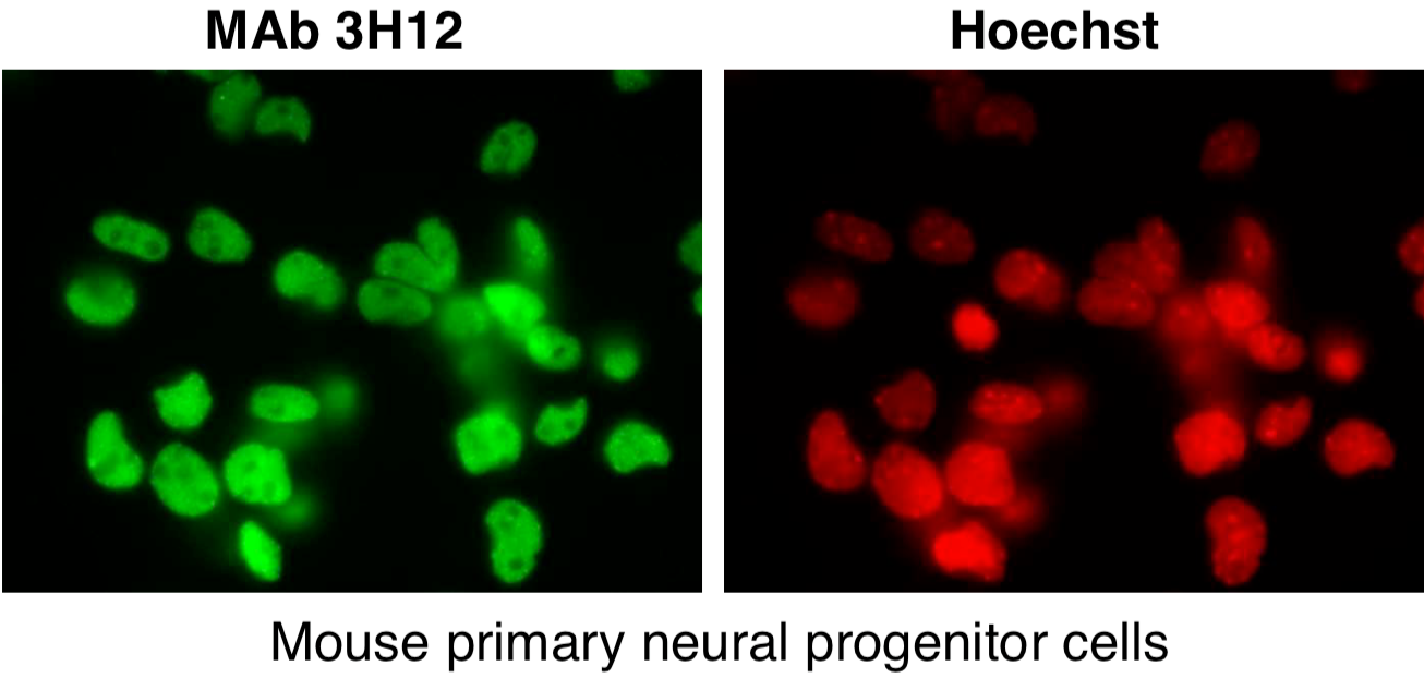 Immunocytochemistry/Immunofluorescence analysis of SUMO2/3 antibody (3H12) on mouse primary culture neurons.
