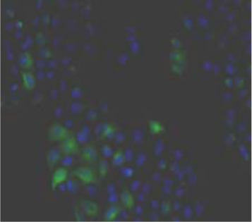 Immunohistochemistry.
Hela cells ICAFectin441-transfected with a plasmid encoding human GPNMB were fixed, permeabilized and stained with rabbit anti-human GPNMB polyclonal IgG antibody (diluted 1/100) and Alexa488 goat anti rabbit IgG secondary antibody. Nuclei were counterstained with DAPI.
