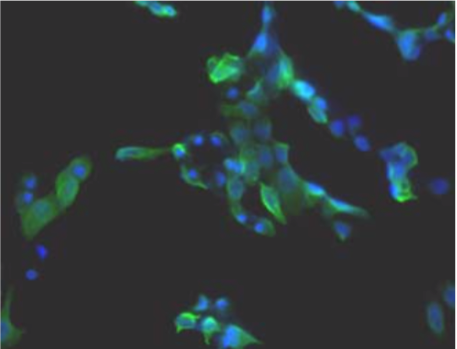 Figure 1. Immunohistochemistry.Hela cells ICAFectin441-transfected with a plasmid encoding mouse WDR45L were fixed, permeabilized and stained with rat anti-human ITIH4 serum (diluted 1/100) and Alexa488 goat anti mouse IgG secondary antibody. Nuclei were counterstained with DAPI.