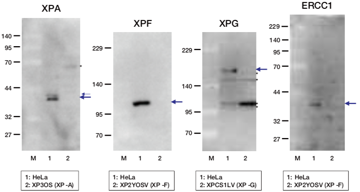 Figure 2. Western blot detection using nucleotide excision repair factor related antibodies.