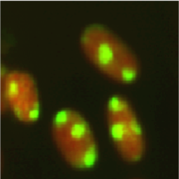 Figure 3. Fluorescent image of localized CPDs in normal human fibroblasts.
Cells were cultured in a 35-mm glass-bottom dish for 24 hours. Immediately after micropore UV irradiation (100 J/m2), cells were fixed and permeabilized. After denaturation of DNA, CPDs (yellow) were visualized using immunofluorescence with clone TDM-2. Nuclear DNA (red) was counterstained with propidium iodide. A filter with 3-μm pores was used.