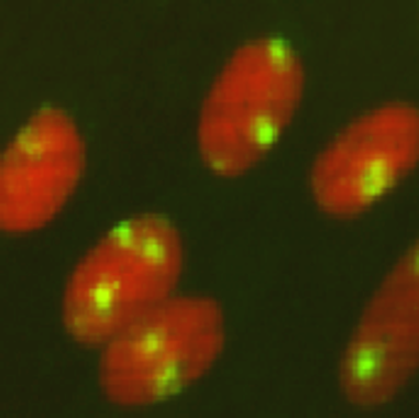 Figure 3. Fluorescent image of localized 6-4PPs in normal human fibroblasts.Cells were cultured in a 35-mm glass-bottom dish for 24 hours. Immediately after micropore UV irradiation (100 J/m2), cells were fixed and permeabilized. After denaturation of DNA, 6-4PPs (yellow) were visualized using immunofluorescence with clone 64M-2. Nuclear DNA (red) was counterstained with propidium iodide. A filter with 3-μm pores was used.