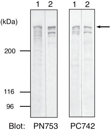 Figure 1. Western blot analysis.
Whole cell lysates prepared from DJM-1 cells (lane 1) and HeLa cells (lane 2) were separated by SDS-PAGE (5% gel) and immunoblotted with PN753 or PC742 (1: 200 dilution). Plectin antibodies detected approximately 500 kDa sized bands (arrow). The smaller polypeptide found in lane 2 may be a degraded product or alternatively spliced rod-less isoform of plectin.