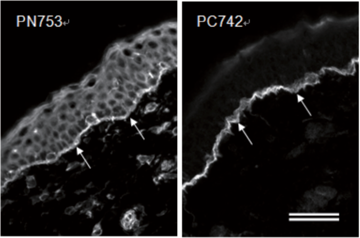 Figure 3. Immunofluorescence microscopy of human skin.
Human skin sections were stained with PC742 (1:100 dilution) or PN753 (1:100 dilution). Arrows indicate dermal-epidermal junctions. PN753 stains epidermal cells in addition to hemidesmosomes at the dermal-epidermal junction. Section were fixed with -20°C acetone for 10 min. Bar: 50 um.
