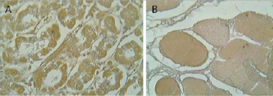 Figure 2. Immunohistochemistry on (A) human intestine and (B) human skeletal muscle.