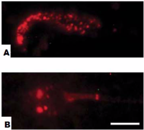 Figure 3. Immunofluorescence staining of rat epididymal sperm and human ejaculated sperm.
(A) Smear preparation of rat sperm. (B) Human ejaculated sperm. Bar = 5 um.