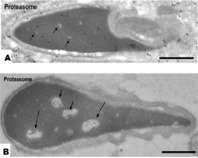 Figure 4. Immuno-electron microscopic localization of proteasomes.
(A) Step 19 spermatids. Nuclear staining becomes weaker. Some gold particles are present in clear spots (arrows). Bar = 0.5 um.
(B) Nuclei of human ejaculated sperm Gold labeling is observed in the clear spots (short arrows) and in the vacuoles (long arrows) but not in the dense matrix. Bar = 0.5 um.