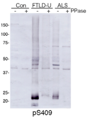 Figure 1. Immunoblot analysis with pAb pS409.Predicted molecular weight: Phosphorylated full-length TDP-43 at 45 kDa, non-phosphorylated TDP-43 at 43 kDa, - 25 kDa fragments and smearing substances in frontotemporal lobar degeneration (FTLD-U) and ALS.