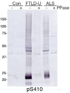 Figure 1. Immunoblot analysis with pAb pS410.Predicted molecular weight: Phosphorylated full-length TDP-43 at 45 kDa, non-phosphorylated TDP-43 at 43 kDa, - 25 kDa fragments and smearing substances in frontotemporal lobar degeneration (FTLD-U) and ALS.