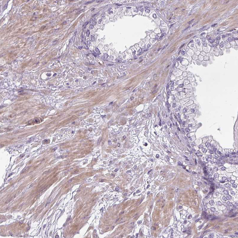 Immunohistochemical staining of human kidney shows strong cytoplasmic and membranous positivity in renal tubules.