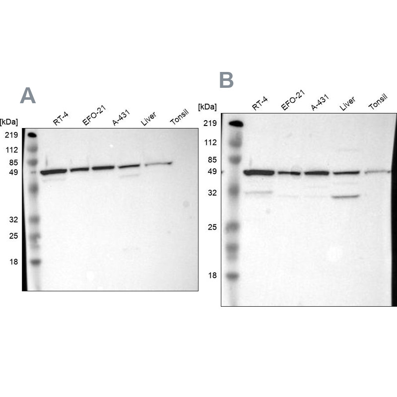 Western blot analysis using Anti-CKAP4 antibody HPA000278 (A) shows similar pattern to independent antibody HPA000792 (B).