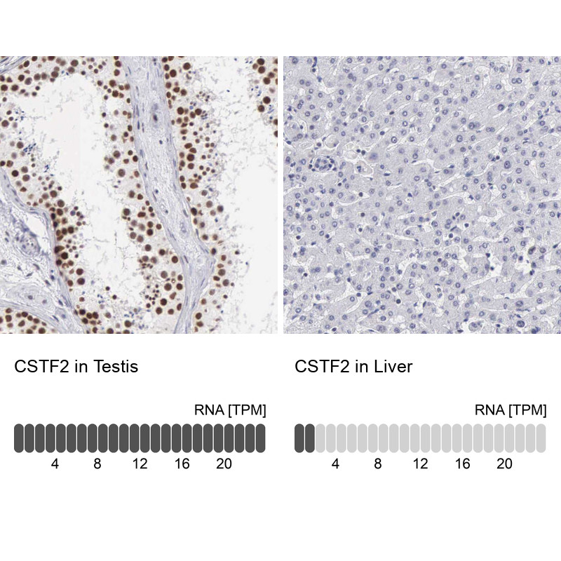 Immunohistochemistry analysis in human testis and liver tissues using Anti-CSTF2 antibody. Corresponding CSTF2 RNA-seq data are presented for the same tissues.