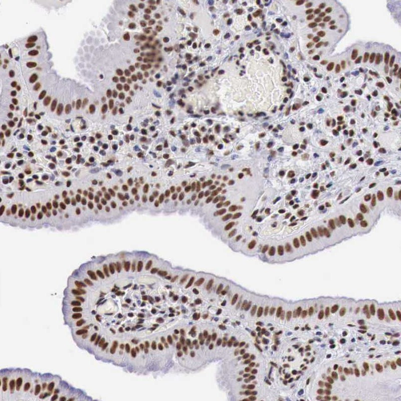 Immunohistochemical staining of human gall bladder shows distinct nuclear positivity in glandular cells.