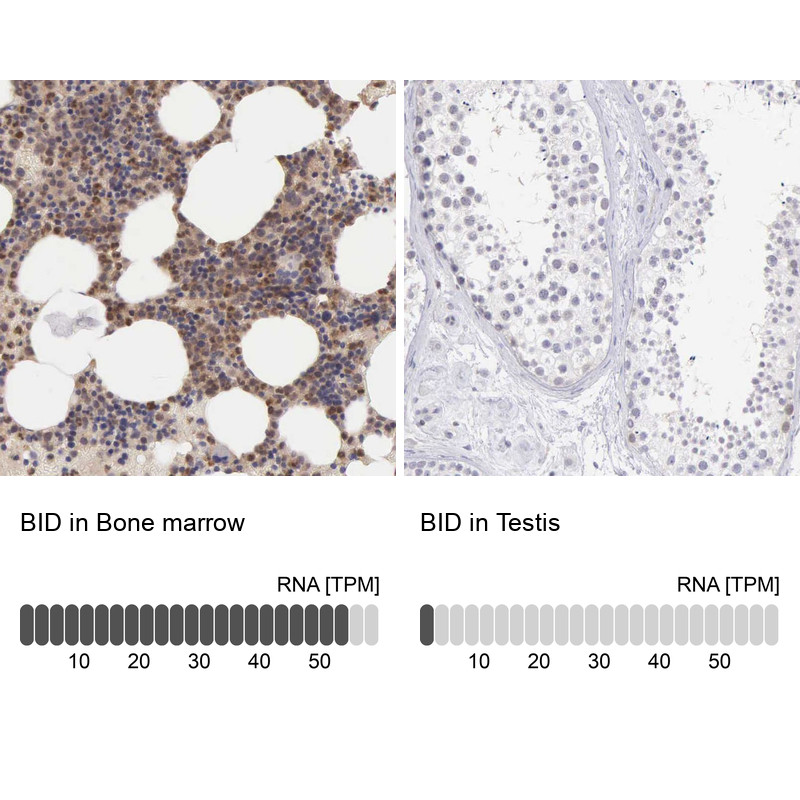 Immunohistochemistry analysis in human bone marrow and testis tissues using Anti-BID antibody. Corresponding BID RNA-seq data are presented for the same tissues.
