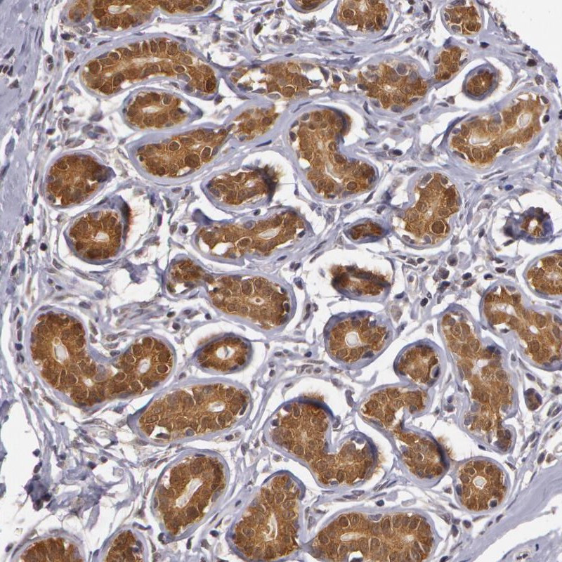 Immunohistochemical staining of human breast shows strong cytoplasmic positivity in glandular cells.