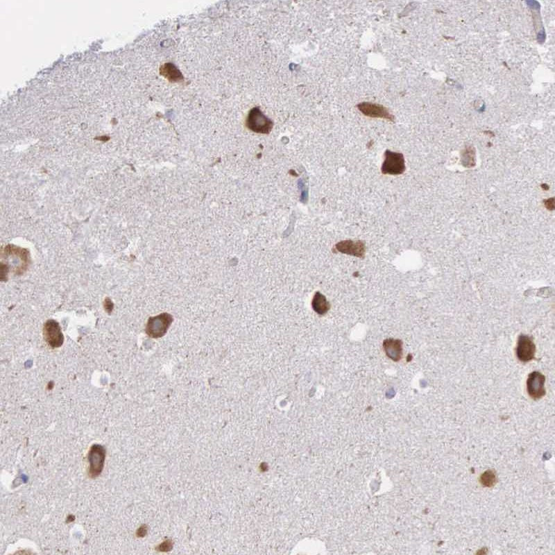 Immunohistochemical staining of human hippocampus shows strong cytoplasmic positivity in neuronal cells.